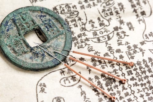 中国鍼の秘密：古代から現代への治療法の進化 | 中国語勉強の教材